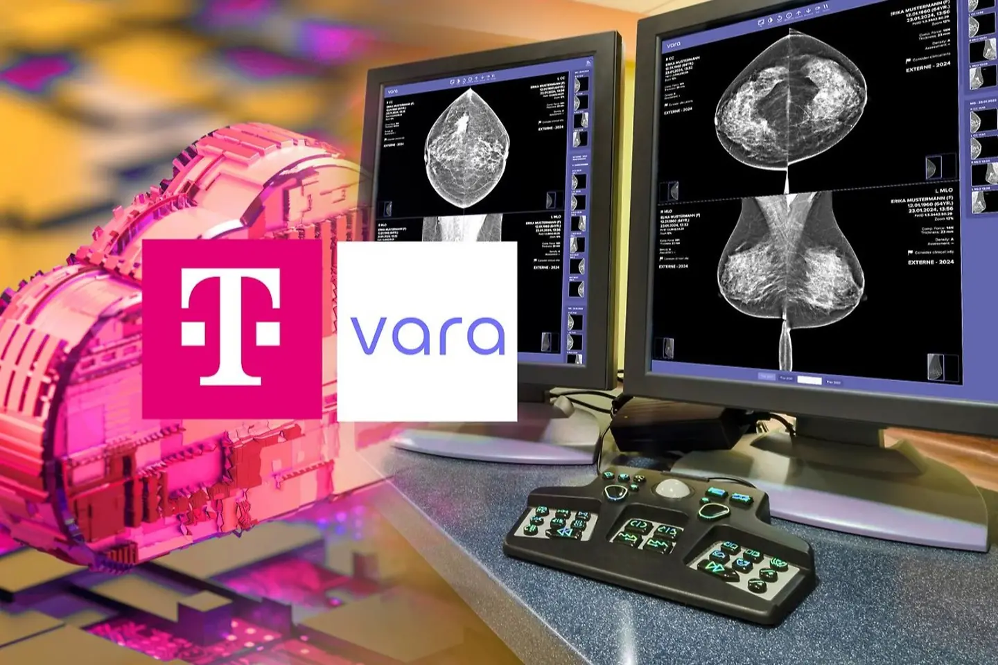 Medizinischer Monitor mit Mammografie-Aufnahmen