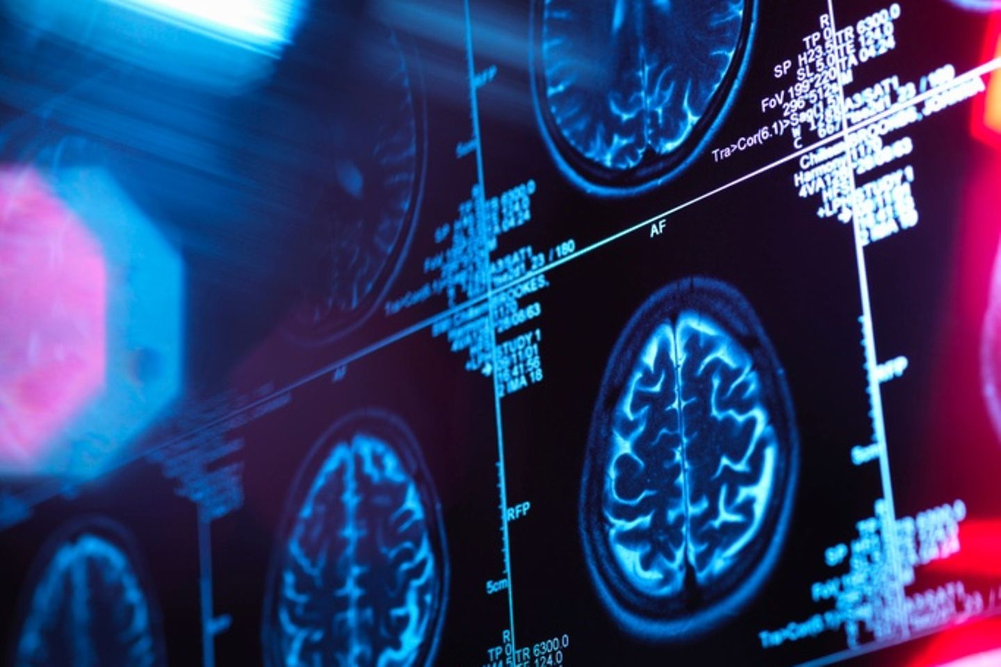 MRI scans of the human brain.