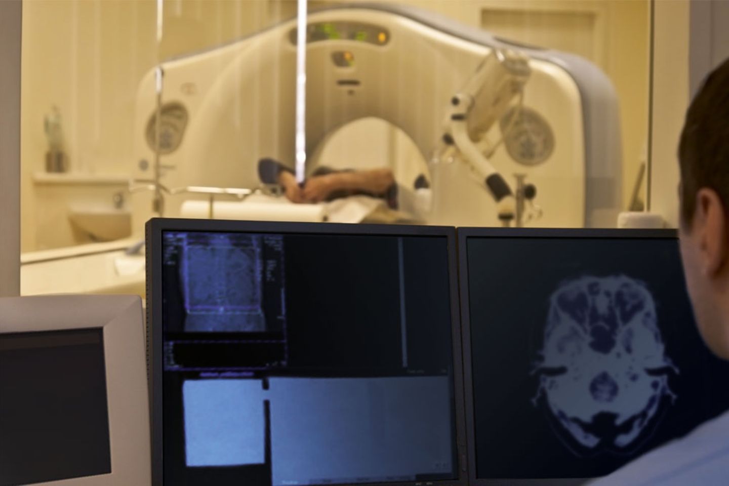 Person with white gown in the foreground works on scan data at a PC screen; in the background an MRI can be seen.