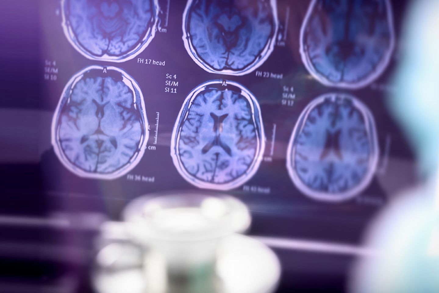 MRT-Bilder vom Gehirn auf dunklem blau violetten Hintergrund.
