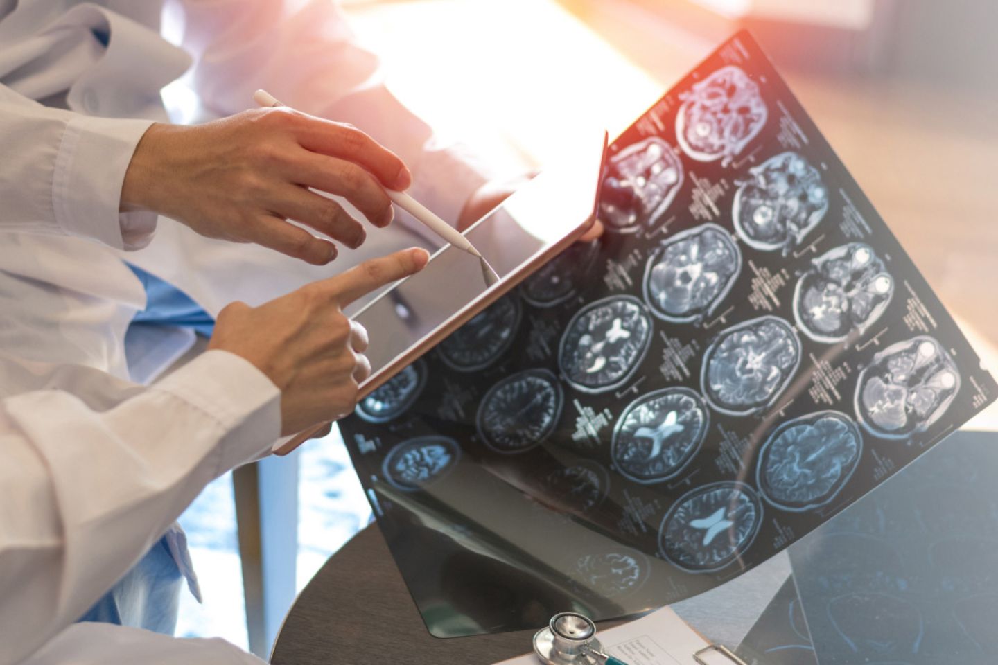Doctors point to a tablet – holding MRI images.