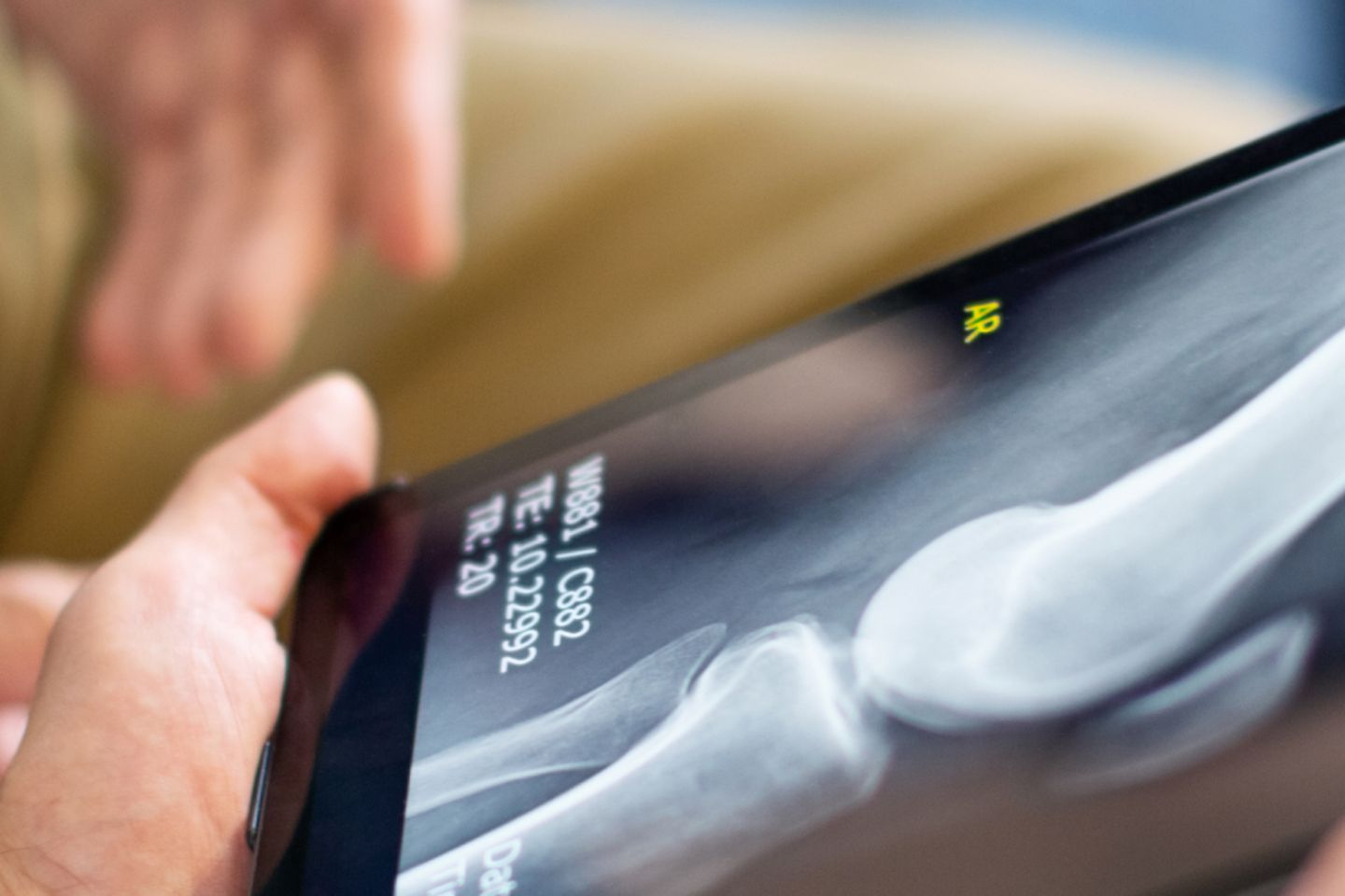 Handen die tablet met röntgenfoto vasthouden. Op de achtergrond vage handen van een andere persoon.